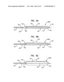 Bifurcation Treatment System and Methods diagram and image