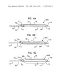 Bifurcation Treatment System and Methods diagram and image