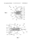 Ophthalmic Injection System diagram and image