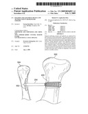 FIXATION AND ALIGNMENT DEVICE AND METHOD USED IN ORTHOPAEDIC SURGERY diagram and image