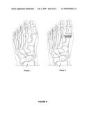 FIXATION AND ALIGNMENT DEVICE AND METHOD USED IN ORTHOPAEDIC SURGERY diagram and image