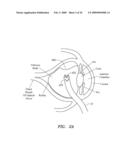 SURGERY METHODS USING A ROBOTIC INSTRUMENT SYSTEM diagram and image