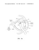 SURGERY METHODS USING A ROBOTIC INSTRUMENT SYSTEM diagram and image