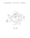 SURGERY METHODS USING A ROBOTIC INSTRUMENT SYSTEM diagram and image