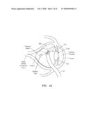 SURGERY METHODS USING A ROBOTIC INSTRUMENT SYSTEM diagram and image