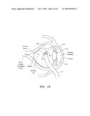 SURGERY METHODS USING A ROBOTIC INSTRUMENT SYSTEM diagram and image