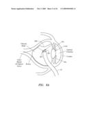 SURGERY METHODS USING A ROBOTIC INSTRUMENT SYSTEM diagram and image