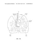 SURGERY METHODS USING A ROBOTIC INSTRUMENT SYSTEM diagram and image