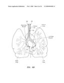 SURGERY METHODS USING A ROBOTIC INSTRUMENT SYSTEM diagram and image