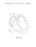 SURGERY METHODS USING A ROBOTIC INSTRUMENT SYSTEM diagram and image