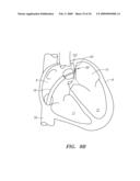 SURGERY METHODS USING A ROBOTIC INSTRUMENT SYSTEM diagram and image