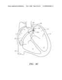 SURGERY METHODS USING A ROBOTIC INSTRUMENT SYSTEM diagram and image