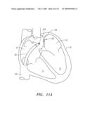 SURGERY METHODS USING A ROBOTIC INSTRUMENT SYSTEM diagram and image