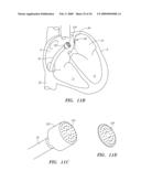 SURGERY METHODS USING A ROBOTIC INSTRUMENT SYSTEM diagram and image