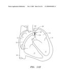 SURGERY METHODS USING A ROBOTIC INSTRUMENT SYSTEM diagram and image