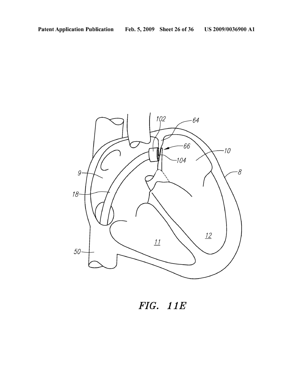 SURGERY METHODS USING A ROBOTIC INSTRUMENT SYSTEM - diagram, schematic, and image 27