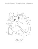 SURGERY METHODS USING A ROBOTIC INSTRUMENT SYSTEM diagram and image