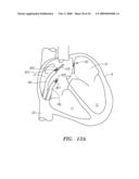 SURGERY METHODS USING A ROBOTIC INSTRUMENT SYSTEM diagram and image