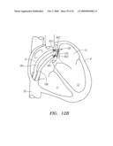 SURGERY METHODS USING A ROBOTIC INSTRUMENT SYSTEM diagram and image