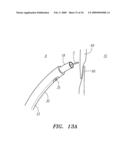 SURGERY METHODS USING A ROBOTIC INSTRUMENT SYSTEM diagram and image