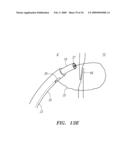 SURGERY METHODS USING A ROBOTIC INSTRUMENT SYSTEM diagram and image