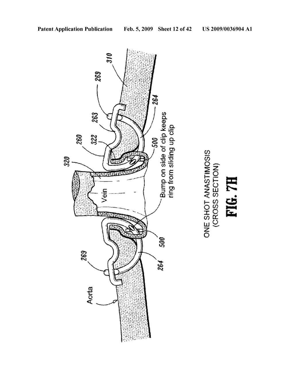 Anastomosis Instrument and Method for Performing Same - diagram, schematic, and image 13