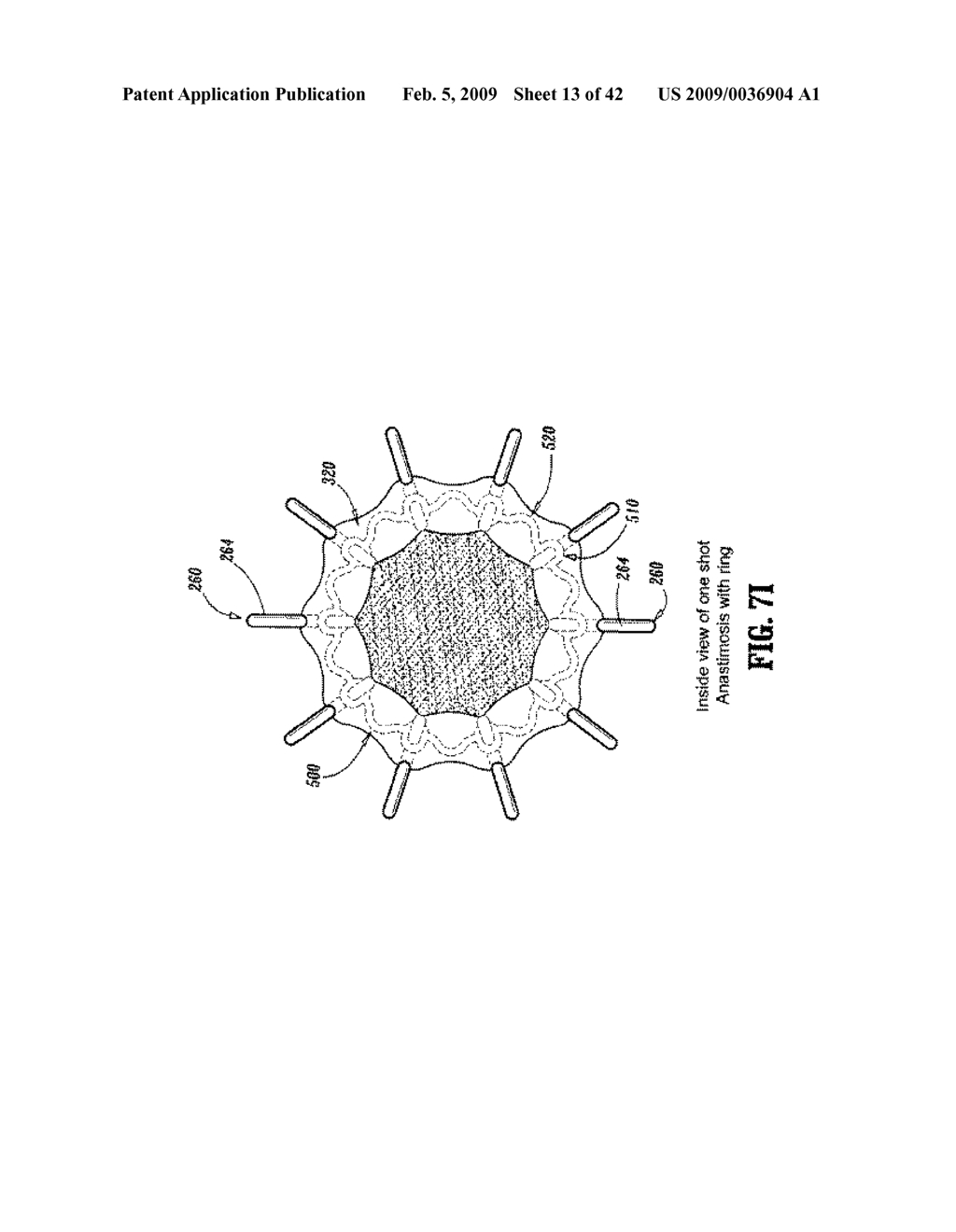 Anastomosis Instrument and Method for Performing Same - diagram, schematic, and image 14