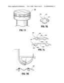 Anastomosis Instrument and Method for Performing Same diagram and image