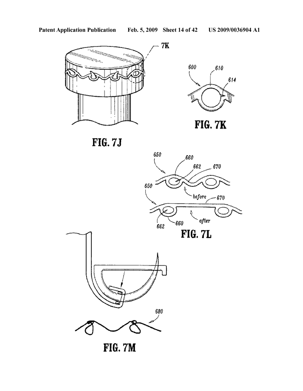 Anastomosis Instrument and Method for Performing Same - diagram, schematic, and image 15