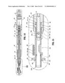 Anastomosis Instrument and Method for Performing Same diagram and image