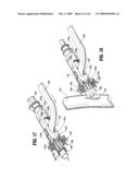 Anastomosis Instrument and Method for Performing Same diagram and image