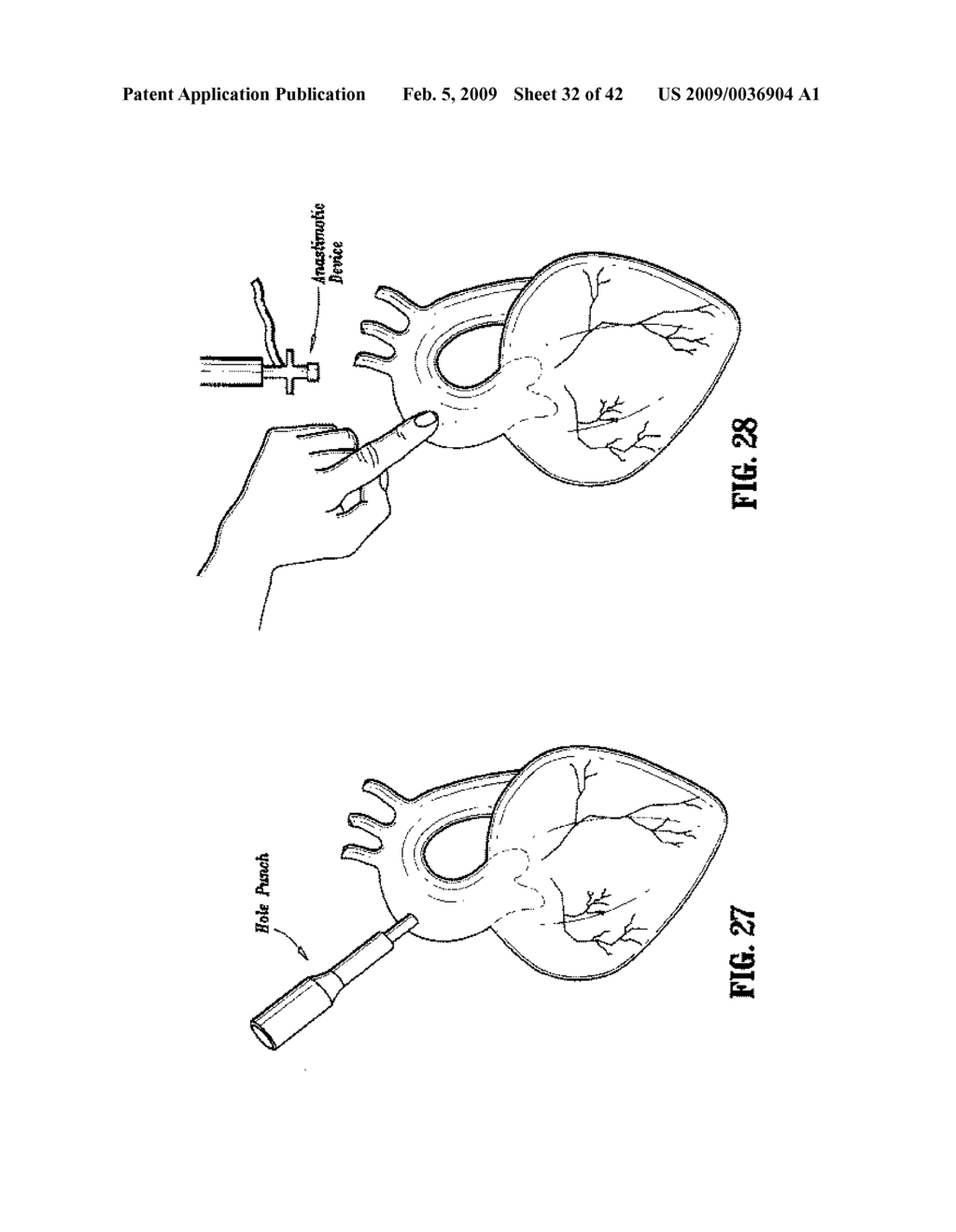 Anastomosis Instrument and Method for Performing Same - diagram, schematic, and image 33