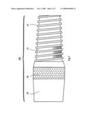 Biologic Barrier for Implants That Pass Through Mucosal or Cutaneous Tissue diagram and image