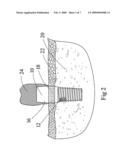 Biologic Barrier for Implants That Pass Through Mucosal or Cutaneous Tissue diagram and image