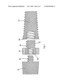 Biologic Barrier for Implants That Pass Through Mucosal or Cutaneous Tissue diagram and image