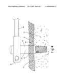 Biologic Barrier for Implants That Pass Through Mucosal or Cutaneous Tissue diagram and image