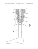 Biologic Barrier for Implants That Pass Through Mucosal or Cutaneous Tissue diagram and image