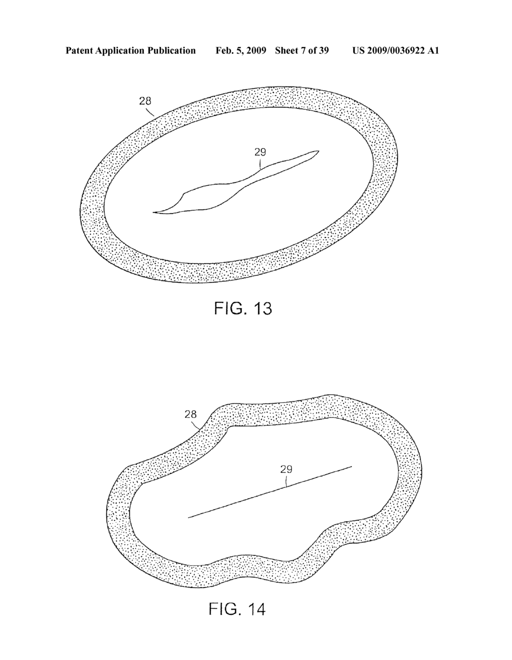 SYSTEMS AND METHODS FOR CLOSING A TISSUE OPENING - diagram, schematic, and image 08