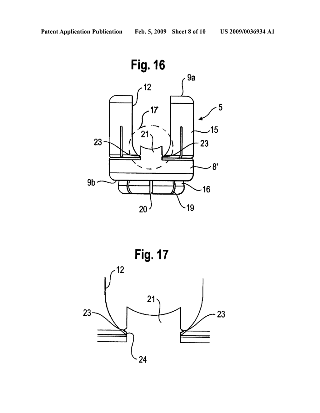 BONE ANCHORING DEVICE - diagram, schematic, and image 09