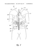 RENAL NERVE STIMULATION METHODS FOR TREATMENT OF PATIENTS diagram and image