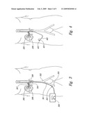 RENAL NERVE STIMULATION METHODS FOR TREATMENT OF PATIENTS diagram and image