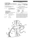 DEVICE FOR MAINTAINING PATENT PARANASAL SINUS OSTIA diagram and image