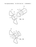 Injectable Intraocular Implants diagram and image