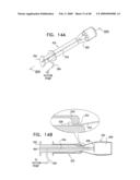 Injectable Intraocular Implants diagram and image