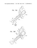 Injectable Intraocular Implants diagram and image