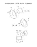 Injectable Intraocular Implants diagram and image