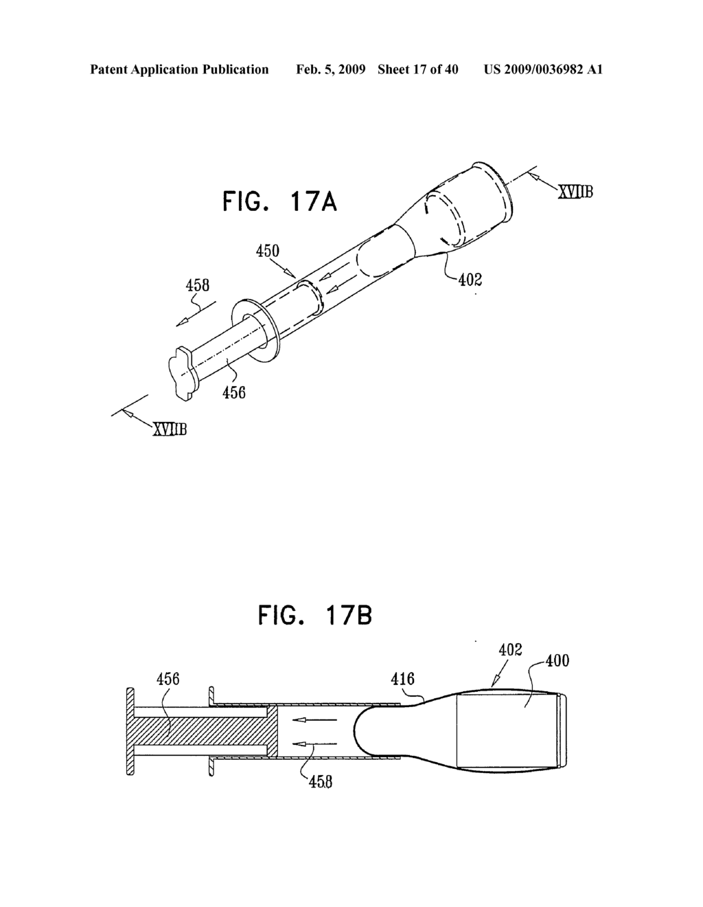 Injectable Intraocular Implants - diagram, schematic, and image 18