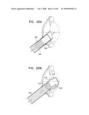 Injectable Intraocular Implants diagram and image