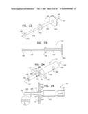 Injectable Intraocular Implants diagram and image