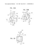 Injectable Intraocular Implants diagram and image